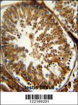 Anti-PAOX Rabbit Polyclonal Antibody