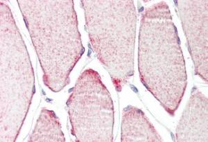 Anti-TRIM54 Antibody (A83909) (3.75 µg/ml) staining of paraffin embedded Human Skeletal Muscle. Steamed antigen retrieval with citrate buffer pH 6, AP-staining