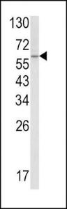 Anti-SCP2 Rabbit Polyclonal Antibody (Biotin)