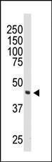 Anti-DOK2 Rabbit Polyclonal Antibody (AP (Alkaline Phosphatase))