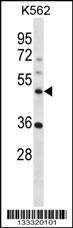 Anti-NLE1 Rabbit Polyclonal Antibody (AP (Alkaline Phosphatase))