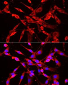 Anti-NNMT antibody