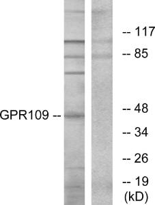 Antibody anti-GPR109 A95743-100 100 µg