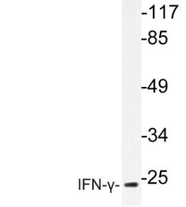 Western blot analysis of lysate from HepG2 cells using Anti-IFN-gamma Antibody