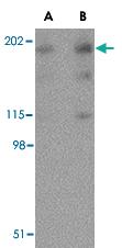 Anti-RTN4 Rabbit Polyclonal Antibody