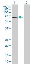 Anti-TUBA8 Rabbit Polyclonal Antibody