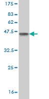 Anti-RCVRN Mouse Monoclonal Antibody [clone: 5A6]