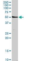 Anti-TUBA8 Rabbit Polyclonal Antibody