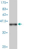 Anti-AR Mouse Polyclonal Antibody