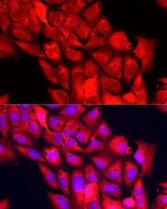 Anti-NNMT antibody