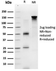 SDS-PAGE analysis of Anti-GTF2A1 Antibody [PCRP-GTF2A1-1F2] under non-reduced and reduced conditions; showing intact IgG and intact heavy and light chains, respectively. SDS-PAGE analysis confirms the integrity and purity of the antibody.