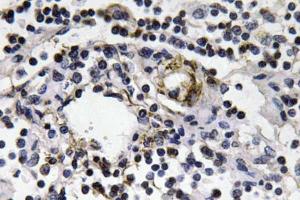 Immunohistochemical analysis of paraffin-embedded human lymph node tissue using Anti-IFN-gamma Antibody