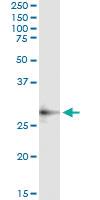 Anti-CECR1 Mouse Monoclonal Antibody [clone: 3D11]