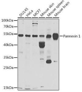 Anti-Pannexin 1 Antibody (A9966)