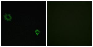 Immunofluorescence analysis of HUVEC cells using Anti-RPL34 Antibody. The right hand panel represents a negative control, where the antibody was pre-incubated with the immunising peptide