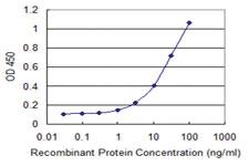 Anti-CECR1 Mouse Monoclonal Antibody [clone: 3D11]