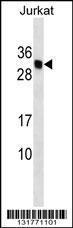 Anti-HLA-DMB Rabbit Polyclonal Antibody (PE (Phycoerythrin))