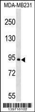 Anti-KIT Rabbit Polyclonal Antibody (FITC (Fluorescein Isothiocyanate))