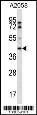 Anti-FIBP Rabbit Polyclonal Antibody (HRP (Horseradish Peroxidase))