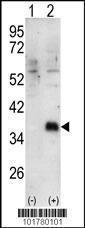 Anti-DOK4 Rabbit Polyclonal Antibody (APC (Allophycocyanin))