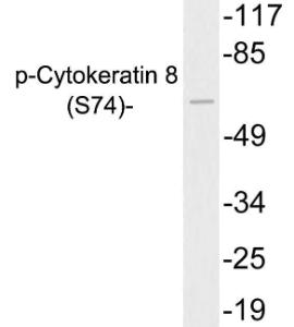 Western blot analysis of lysates from 293 cells treated with UV using Anti-Cytokeratin 8 (phospho Ser74) Antibody