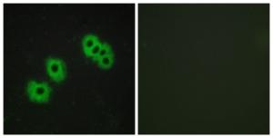 Immunofluorescence analysis of MCF7 cells using Anti-GPR105 Antibody The right hand panel represents a negative control, where the antibody was pre-incubated with the immunising peptide