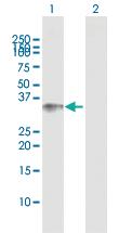 Anti-BCL11A Rabbit Polyclonal Antibody