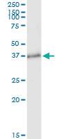 Anti-BCL11A Rabbit Polyclonal Antibody