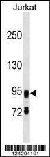 Anti-FIG4 Rabbit Polyclonal Antibody (AP (Alkaline Phosphatase))