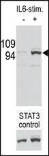 Anti-STAT3 Rabbit Polyclonal Antibody