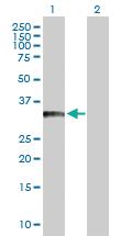 Anti-BCL11A Rabbit Polyclonal Antibody