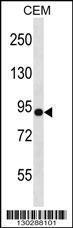 Anti-NLGN4Y Rabbit Polyclonal Antibody (HRP (Horseradish Peroxidase))