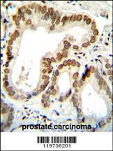 Anti-BTG2 Rabbit Polyclonal Antibody (Biotin)