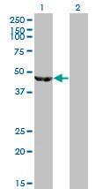 Anti-ENOB Mouse monoclonal antibody [clone: 5D1]