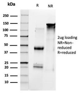 SDS-PAGE analysis of Anti-TFIIB Antibody [PCRP-GTF2B-1D1] under non-reduced and reduced conditions; showing intact IgG and intact heavy and light chains, respectively. SDS-PAGE analysis confirms the integrity and purity of the antibody