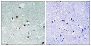 Immunohistochemical analysis of paraffin-embedded human brain tissue using Anti-HP1 alpha Antibody. The right hand panel represents a negative control, where the antibody was pre-incubated with the immunising peptide