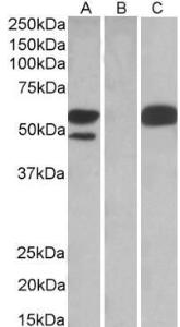 HEK293 lysate (10ug protein in RIPA buffer) overexpressing Human TRIM21 with C-terminal MYC tag probed with Anti-TRIM21 Antibody (A83914)