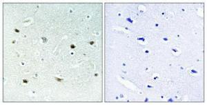 Immunohistochemical analysis of paraffin-embedded human brain using Anti-ERK8 (phospho Thr175+Tyr177) Antibody 1:100 (4°C overnight). The right hand panel represents a negative control, where the antibody was pre-incubated with the immunising peptide