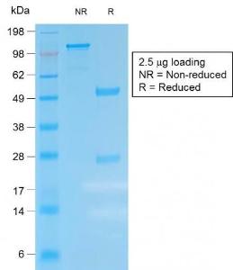 Anti-Kappa Light Chain antibody