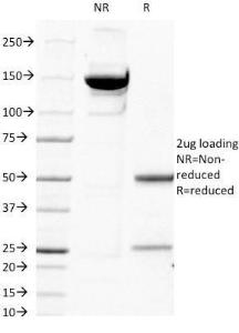 SDS-PAGE analysis of Anti-beta 2 Microglobulin Antibody [B2M/1118] under non-reduced and reduced conditions; showing intact IgG and intact heavy and light chains, respectively. SDS-PAGE analysis confirms the integrity and purity of the antibody