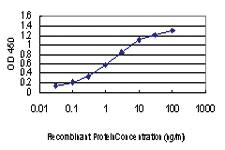 Anti-PAK1 Mouse Monoclonal Antibody [clone: 1E11]