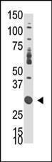 Anti-DOK5 Rabbit Polyclonal Antibody (AP (Alkaline Phosphatase))