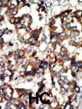 Anti-AIBZIP/CREB3L4 Rabbit Polyclonal Antibody