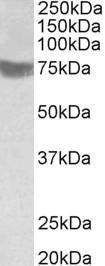 Anti-RNF139 Antibody (A83915) (1µg/ml) staining of Human Skeletal Muscle lysate (35µg protein in RIPA buffer). Primary incubation was 1 hour. Detected by chemiluminescence.