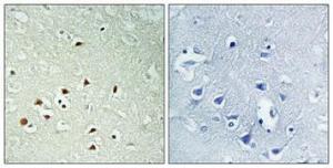 Immunohistochemical analysis of paraffin-embedded human brain using Anti-ERK8 (phospho Thr175+Tyr177) Antibody 1:100 (4°C overnight). The right hand panel represents a negative control, where the antibody was pre-incubated with the immunising peptide