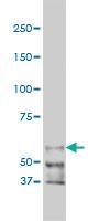 Anti-PAK1 Mouse Monoclonal Antibody [clone: 4D1]