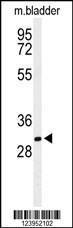 Anti-BASP1 Rabbit Polyclonal Antibody (AP (Alkaline Phosphatase))