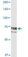 Anti-PTK2 Polyclonal Antibody Pair