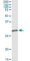 Anti-HLA-DMB Antibody Pair