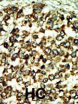 Anti-ATRX Rabbit Polyclonal Antibody